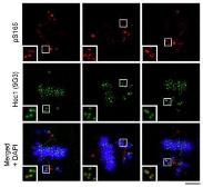 Anti-Hec1 (phospho Ser 165) antibody used in Immunocytochemistry/ Immunofluorescence (ICC/IF). GTX70013